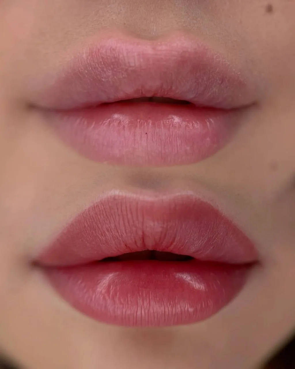 Lip Result