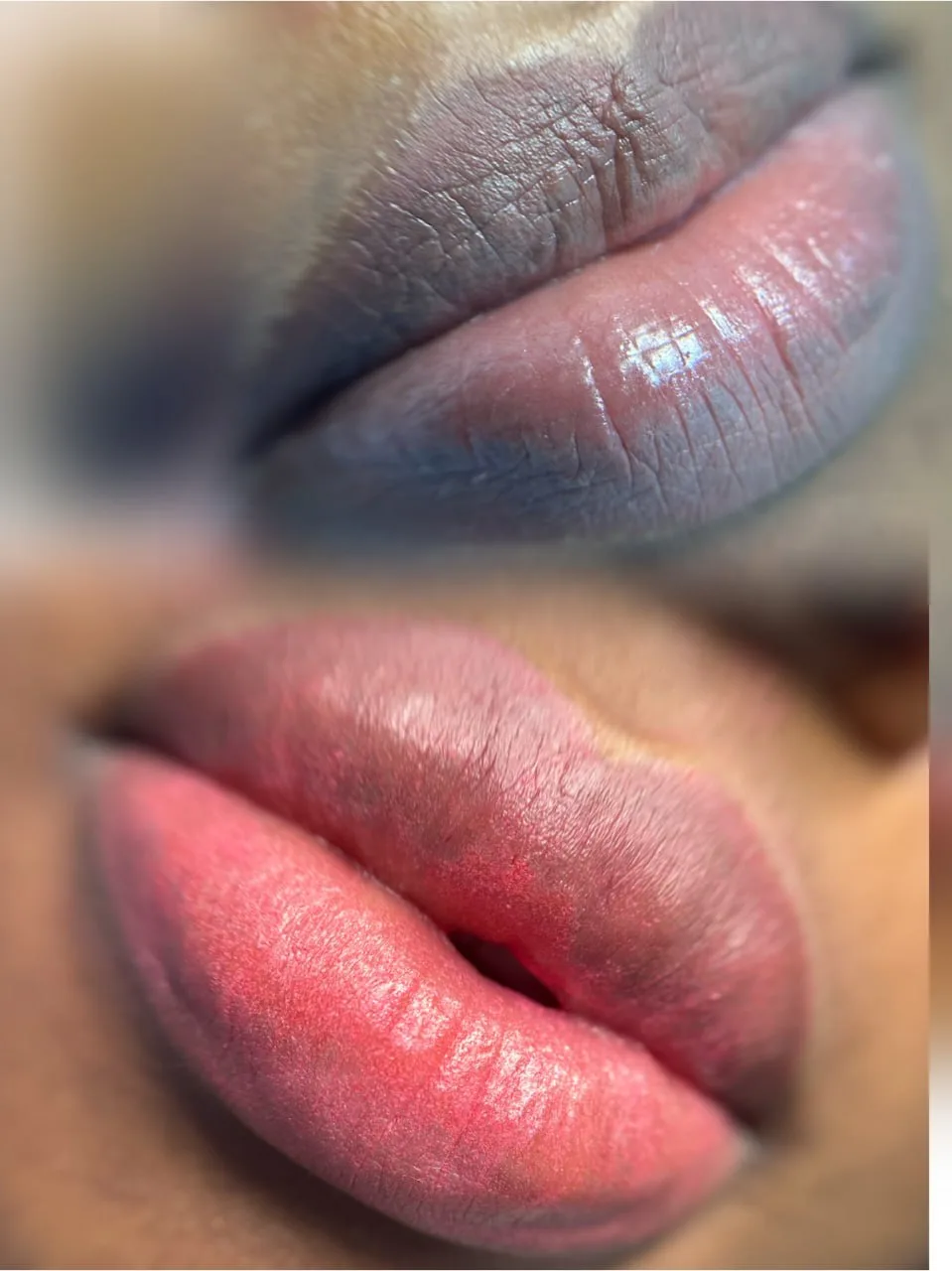 Lip Result