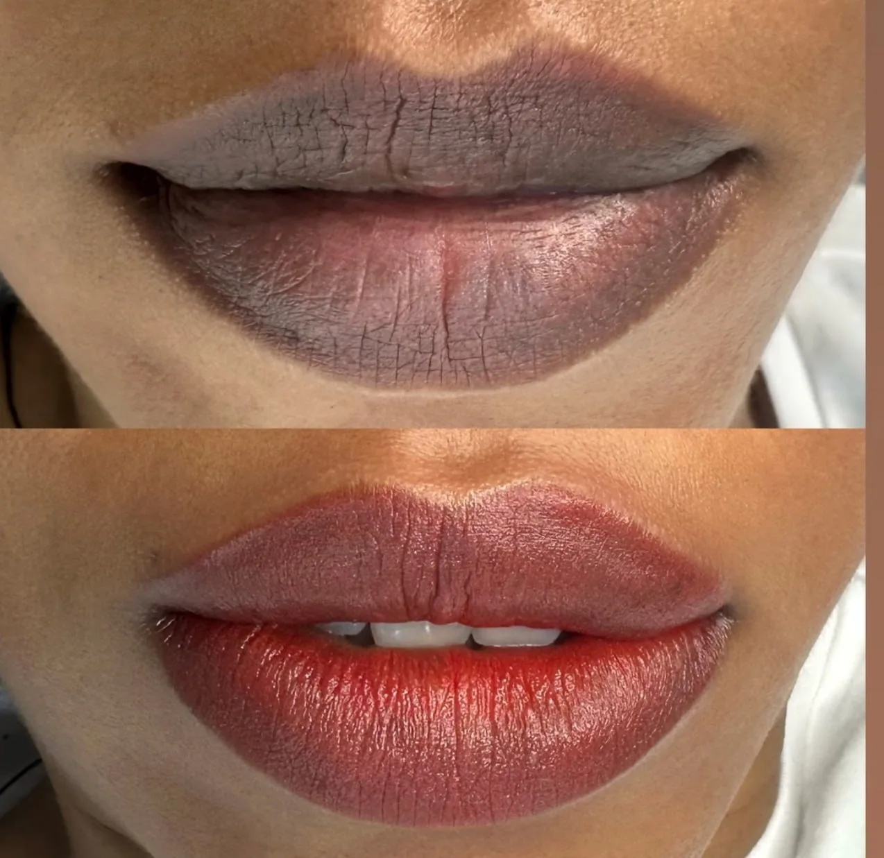 Lip Result